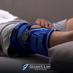 A Mount Vernon personal injury victim with their leg propped up and in a brace.